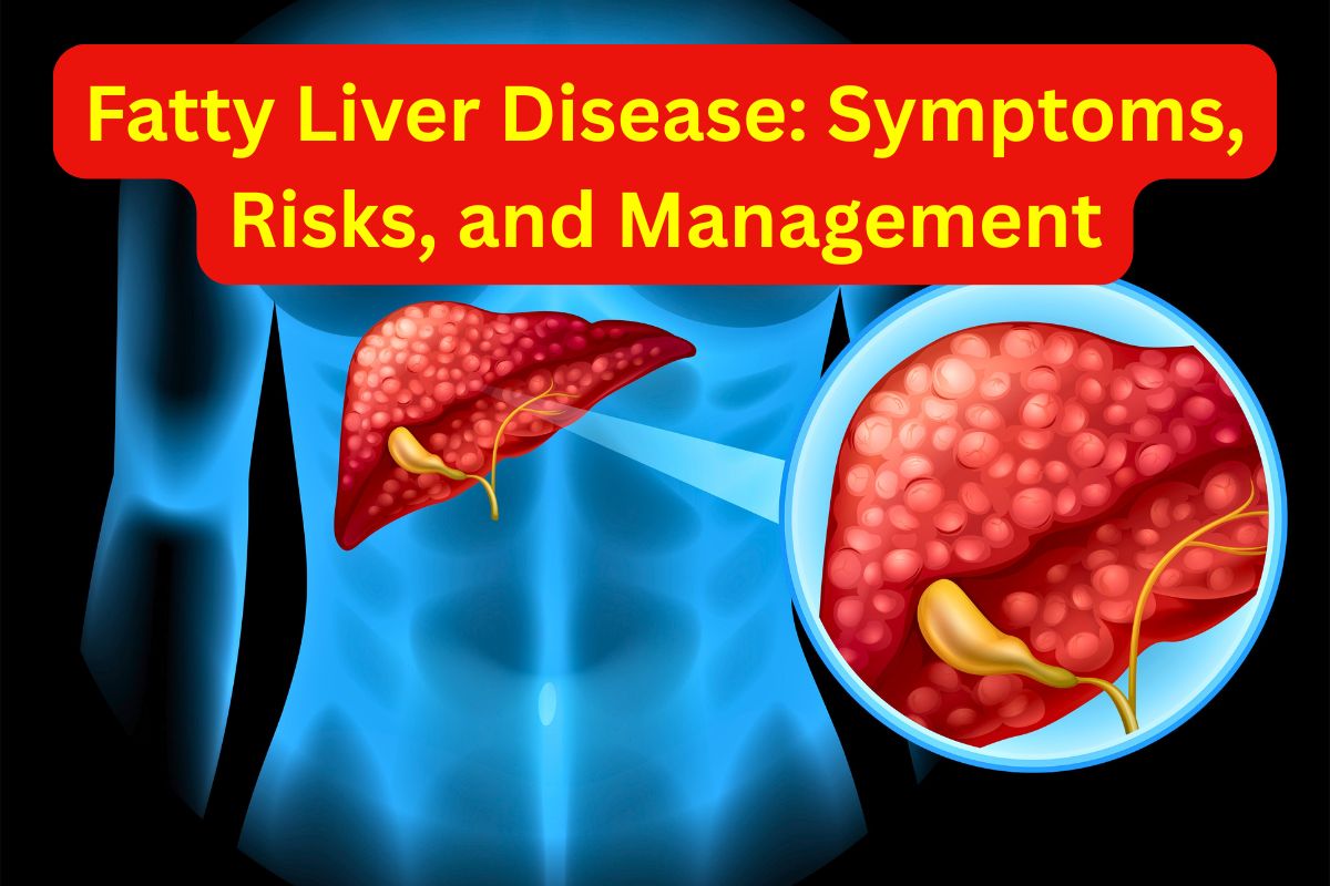Symptoms, Risks, and Management for Fatty Liver Disease